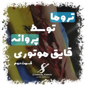 تروما پروانه قایق موتوری