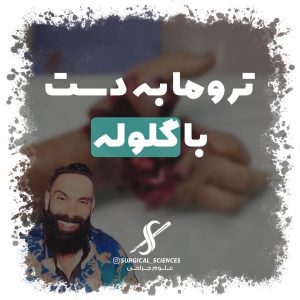 تروما به دست با گلوله