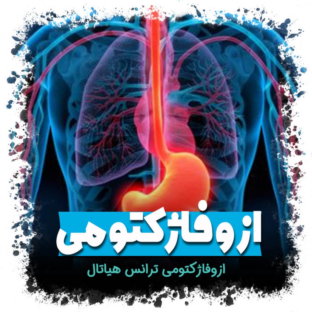 ازوفاژکتومی ترانس هیاتال