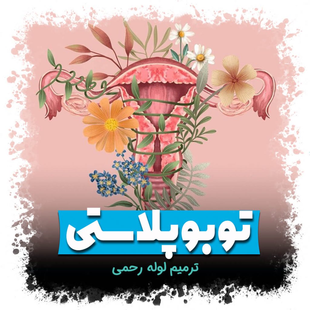 توبوپلاستی