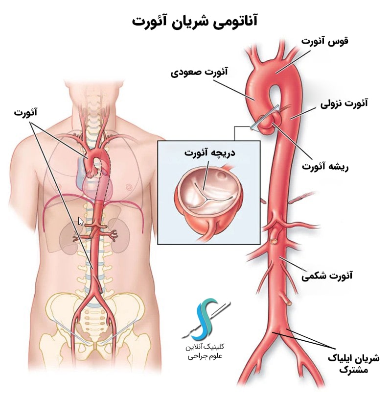 آناتومی آئورت