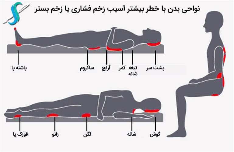 نواحی بدن با خطر بیشتر آسیب زخم بستر