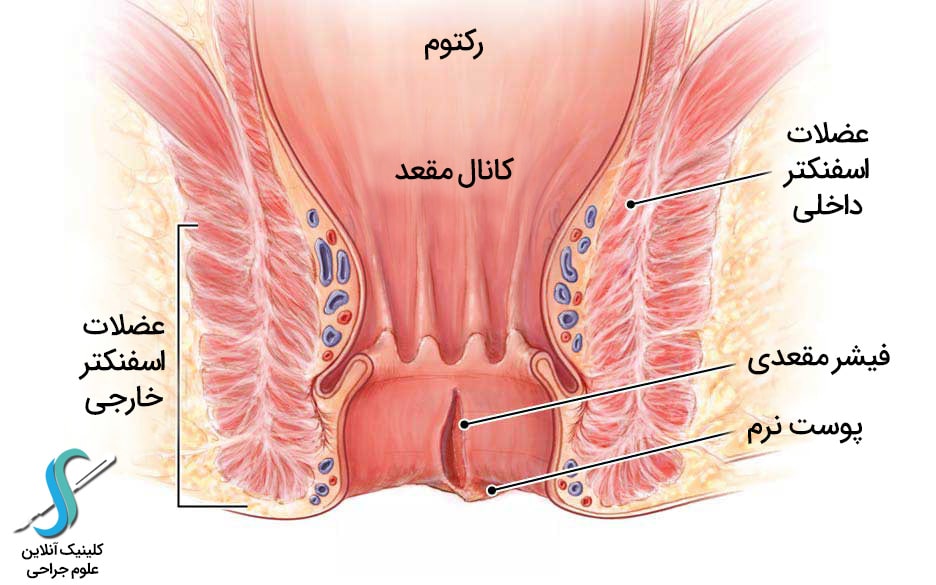 شقاق یا فشار