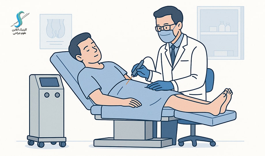 تصویر شماتیک از لیزر درمانی بواسیر توسط پزشک متخصص در کلینیک در سال ۲۰۲۵.