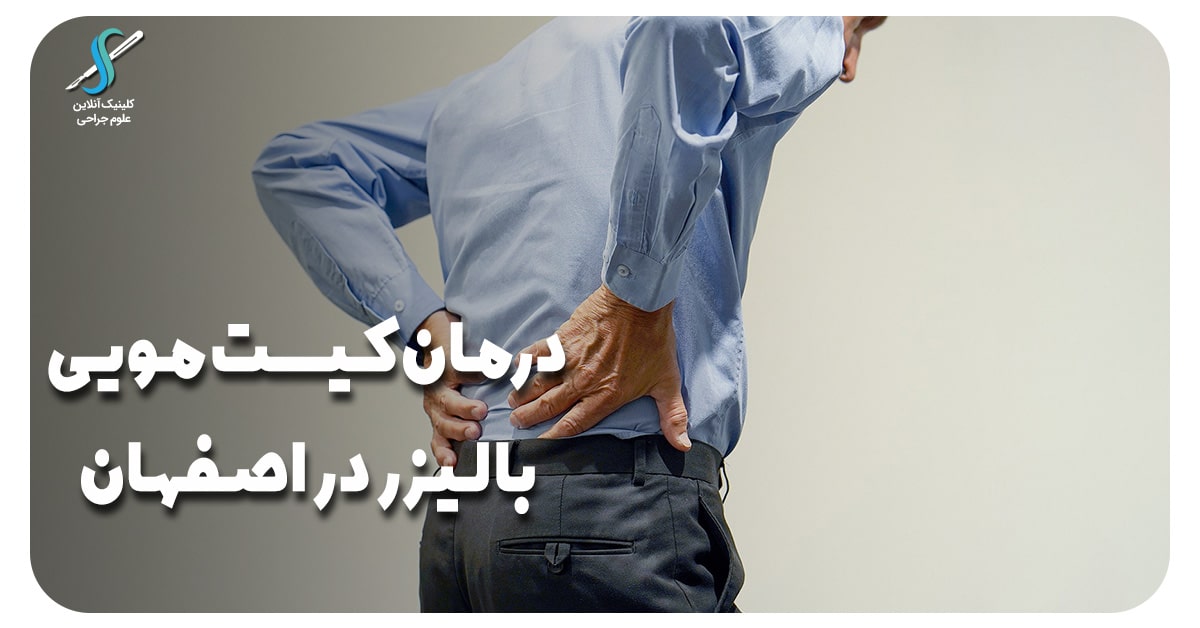 بهترین درمان کیست مویی با لیزر در اصفهان