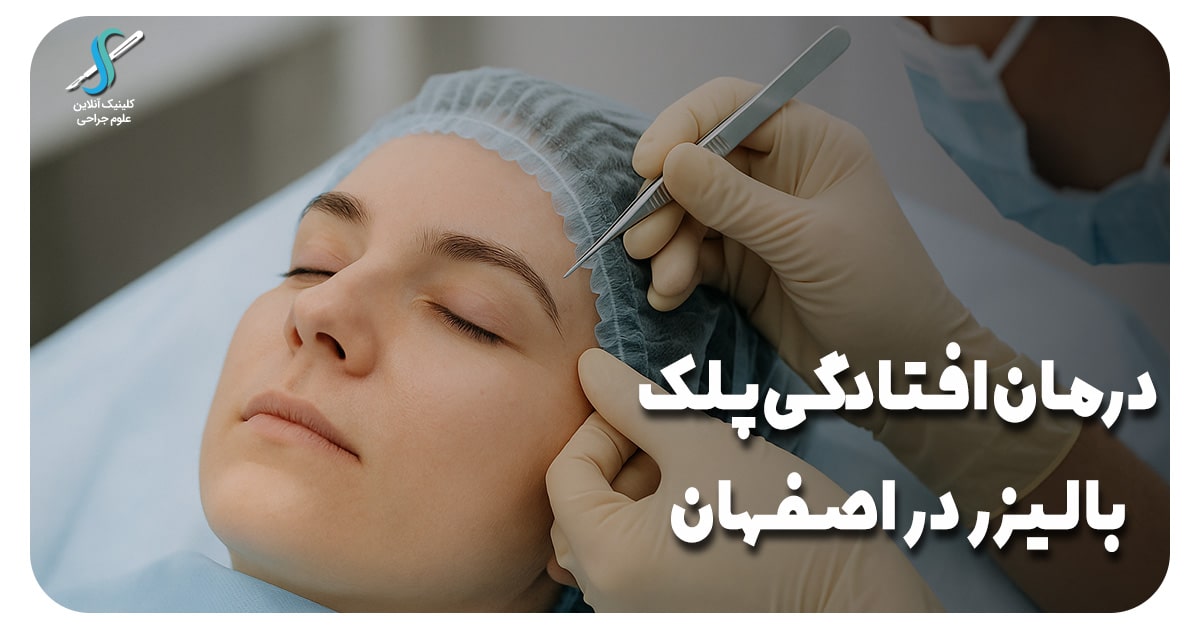درمان افتادگی پلک با لیزر در اصفهان با بهترین متد 2025