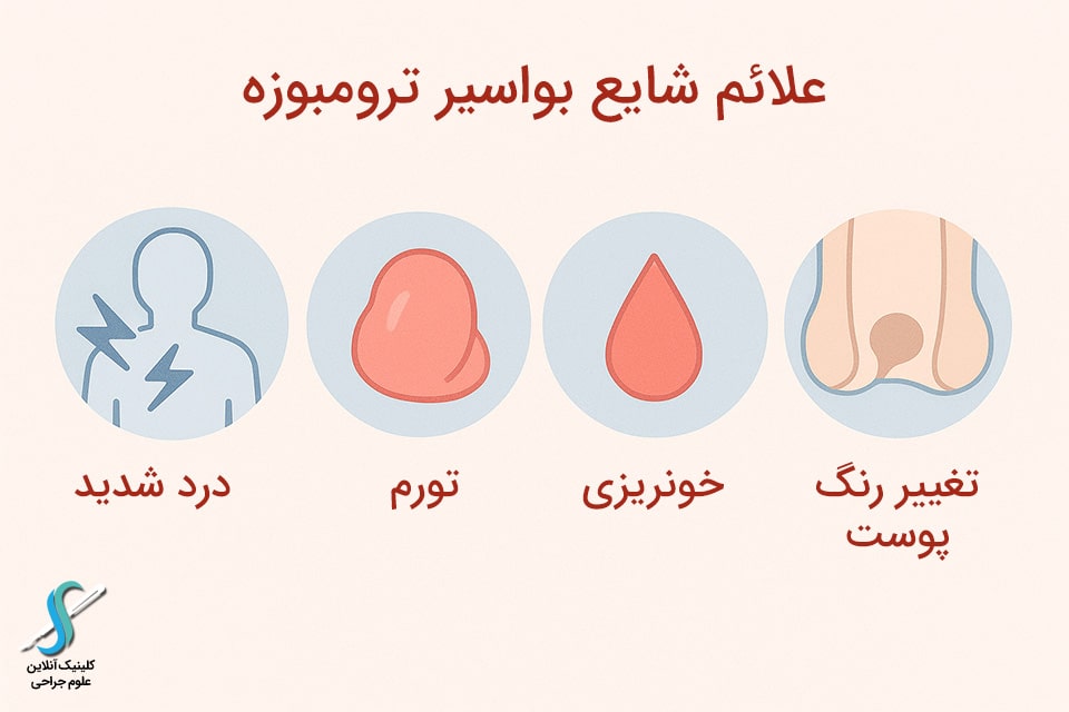 اینفوگرافیک علائم شایع بواسیر ترومبوزه
