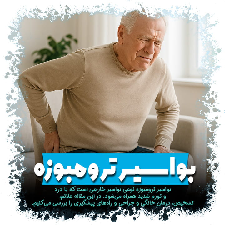 بواسیر ترومبوزه چیست