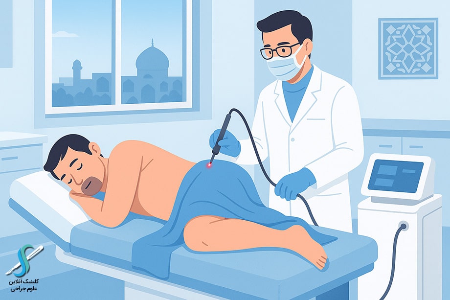 درمان بواسیر با لیزر در اصفهان توسط پزشک متخصص در کلینیک علوم جراحی