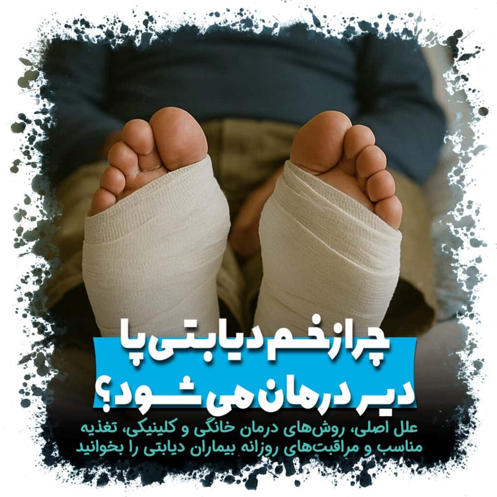 زخم دیابتی پا و علل دیر بهبود یافتن آن