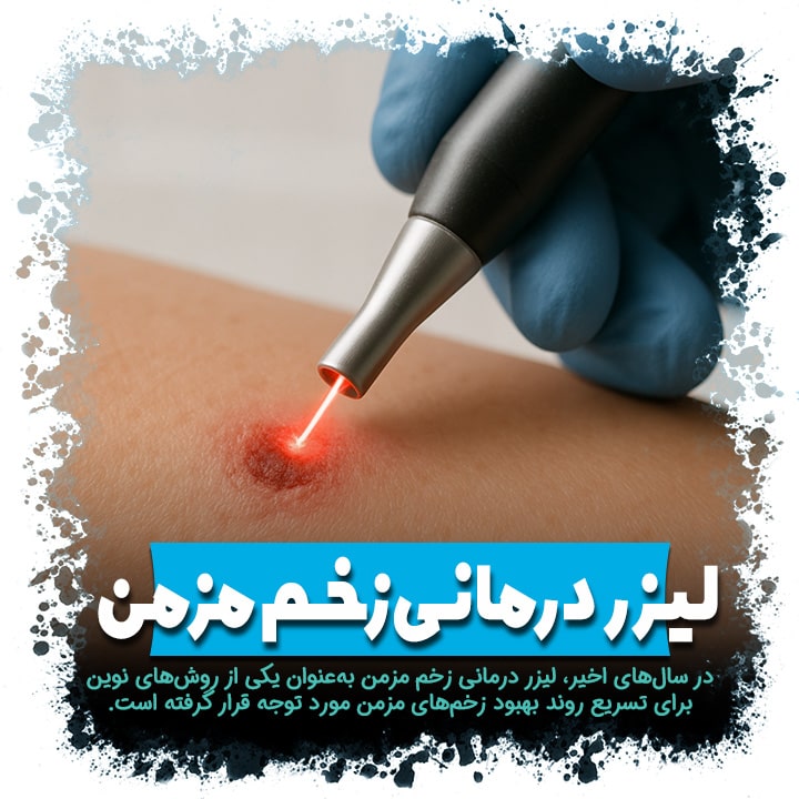 لیزر درمانی زخم مزمن مزایا، روند بهبودی و شواهد علمی